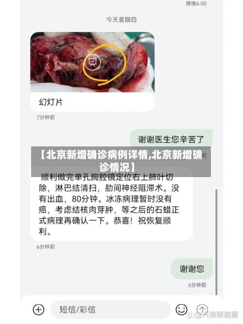 【北京新增确诊病例详情,北京新增确诊情况】