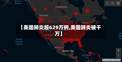 【美国肺炎超629万例,美国肺炎破千万】-第2张图片