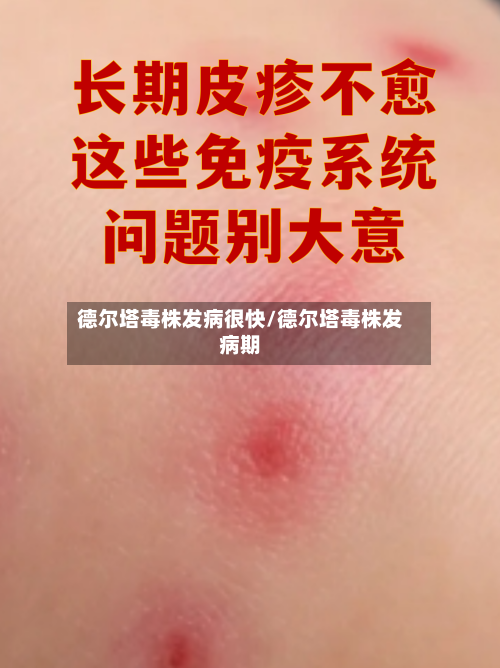 德尔塔毒株发病很快/德尔塔毒株发病期-第2张图片